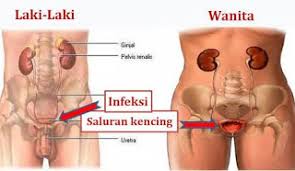 Jual Obat Sipilis De Nature Pengiriman ke Wonosobo