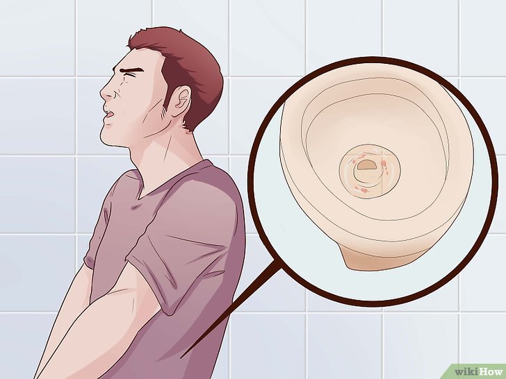 Jual Obat Sipilis De Nature Pengiriman ke Sarolangun